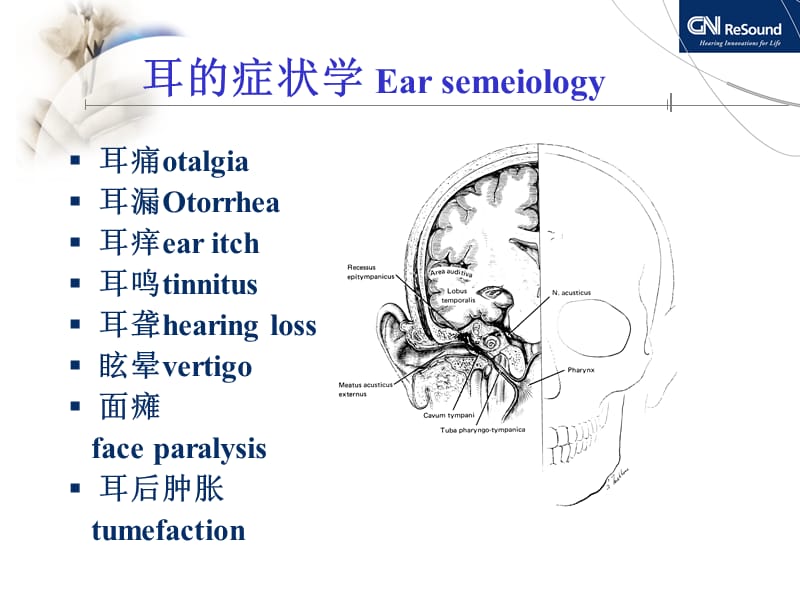 耳聋相关疾病与听力图分析.ppt_第2页