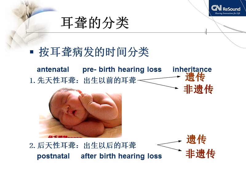 耳聋相关疾病与听力图分析.ppt_第3页