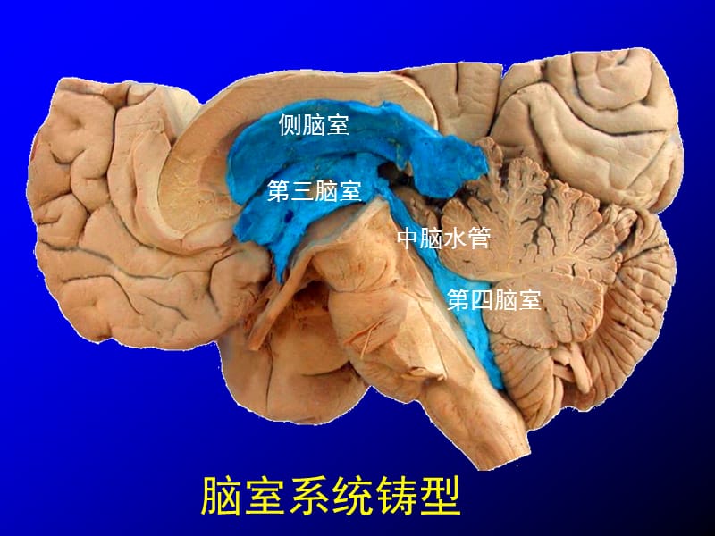 脑室、脑池应用解剖.ppt_第2页