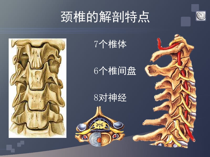 颈椎病的CT诊断.ppt_第3页