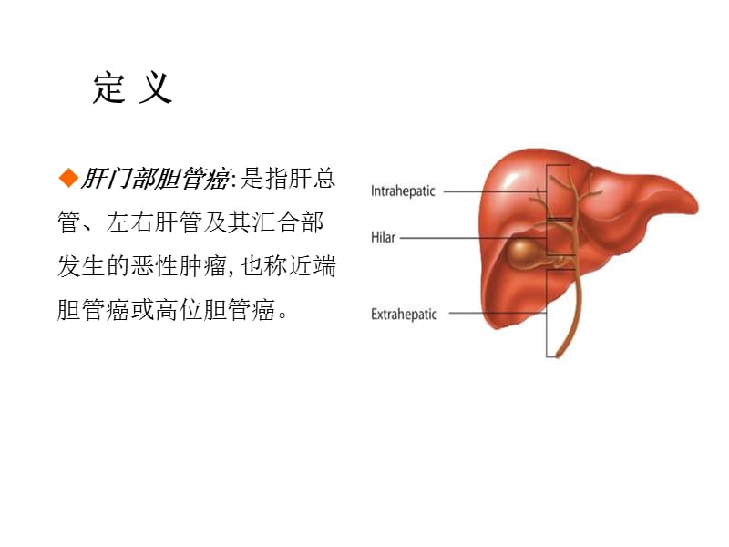 肝门部胆管癌的分型与手术策略.ppt_第3页