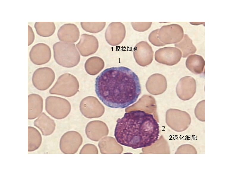 血液学细胞形态学复习(附图片).ppt_第1页