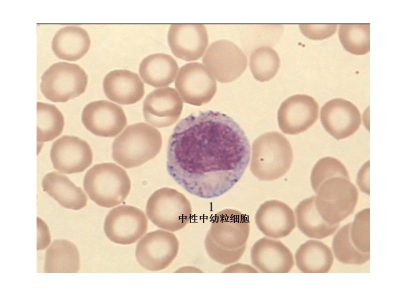 血液学细胞形态学复习(附图片).ppt_第3页