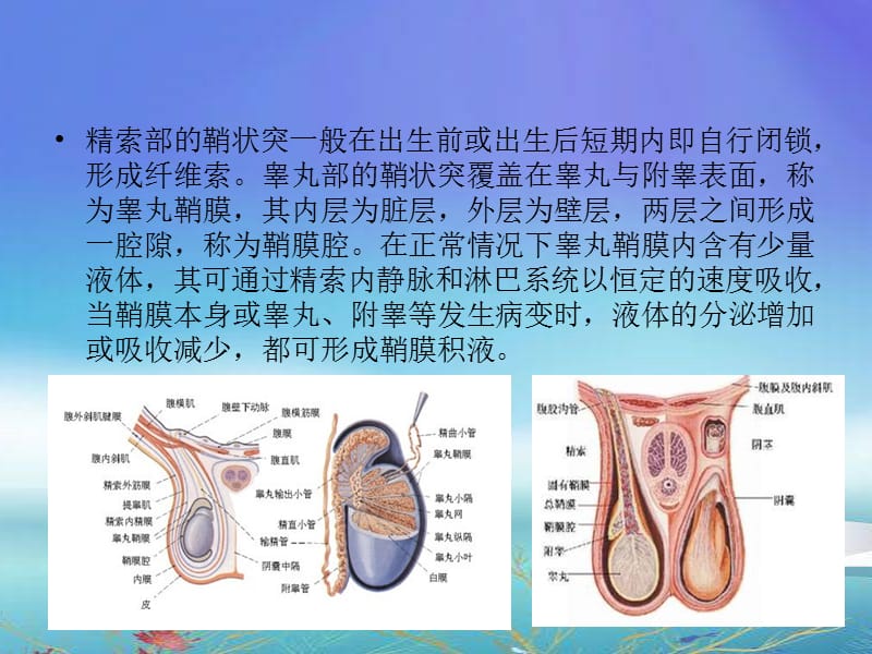 鞘膜积液业务学习ppt课件.ppt_第3页