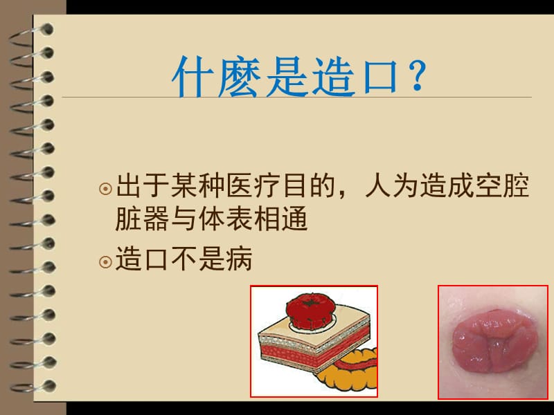 造口护理健康教育.ppt_第2页