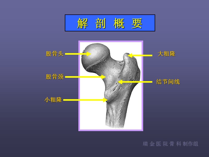 《股骨颈骨折》PPT课件.ppt_第3页