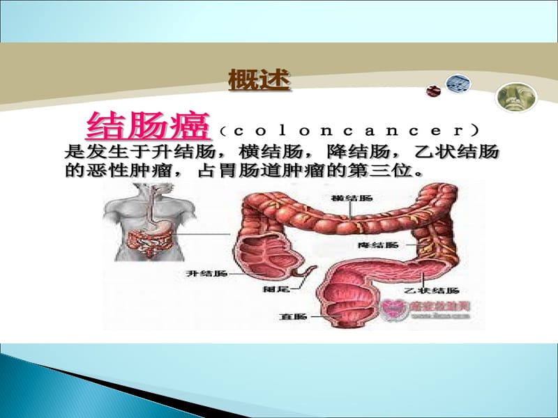 乙状结肠癌的护理查房ppt课件_第2页