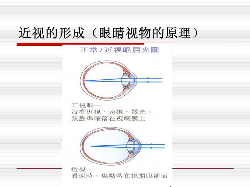 爱护眼睛_预防近视_第3页