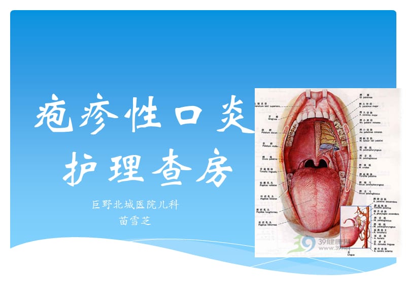 疱疹性口炎护理查房ppt课件_第1页