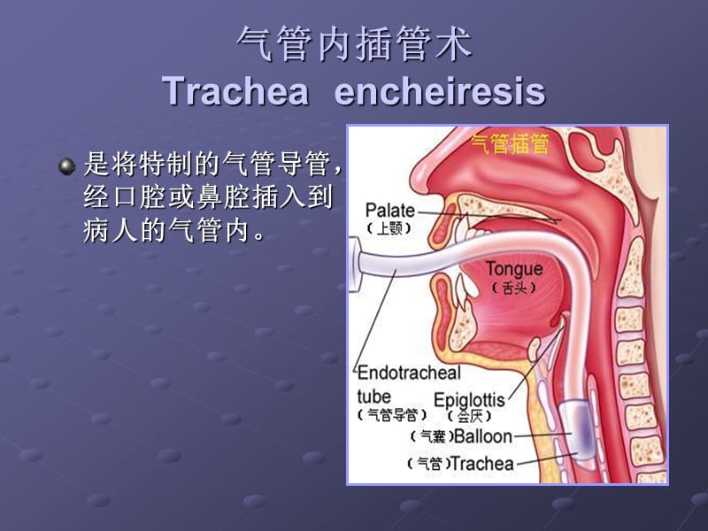 气管插管术ppt课件_第3页