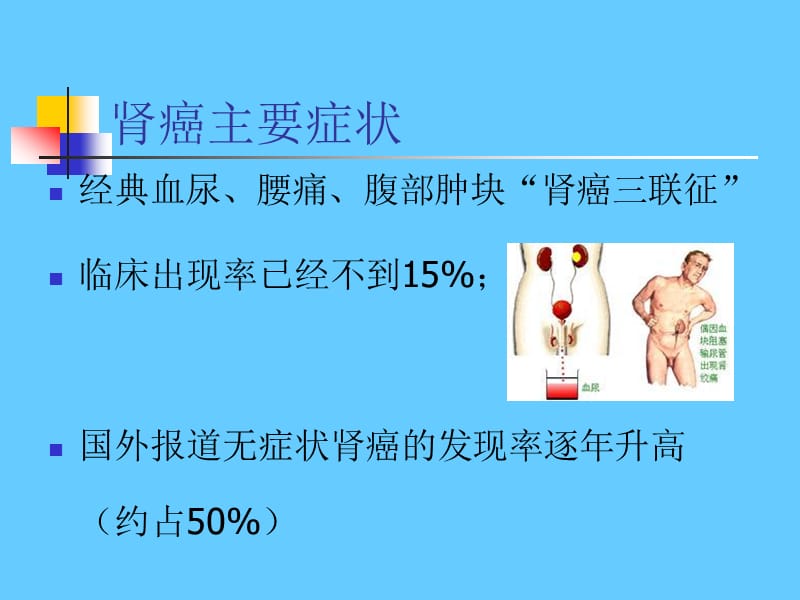 转移性肾癌ppt课件_第2页