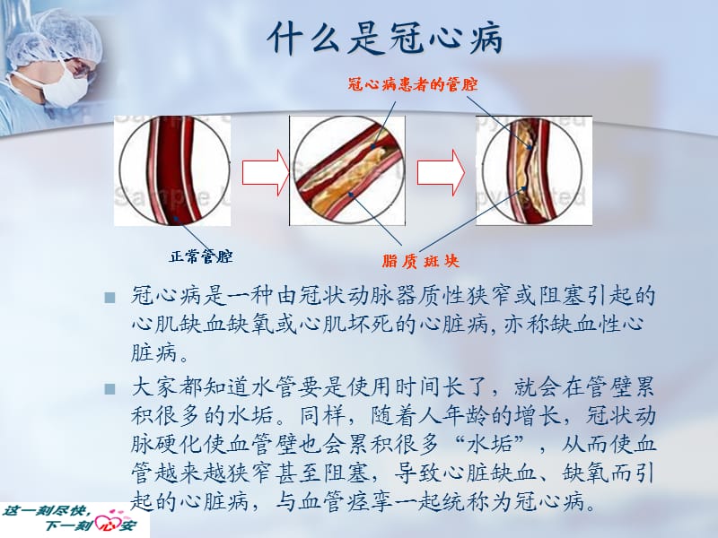 社区演讲幻灯1冠心病心绞痛的防治.ppt_第2页