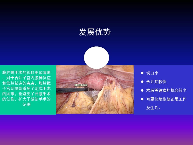 腹腔镜下全宫切护理查房ppt课件(1)_第3页