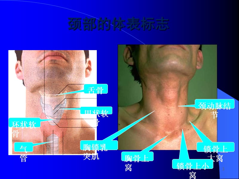 气管切开术ppt课件_第3页