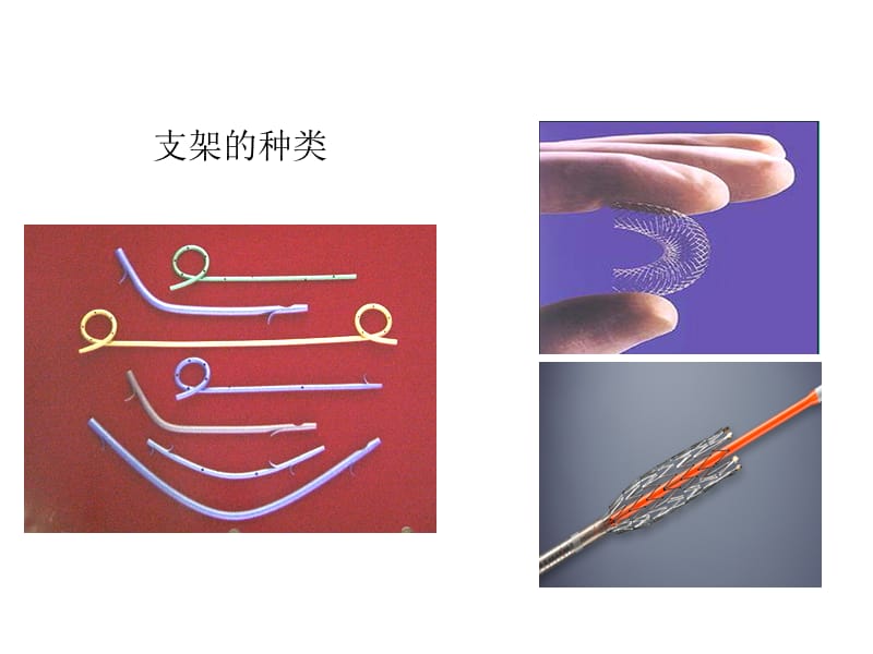 ERCP下胆道胰管支架置入.ppt_第3页