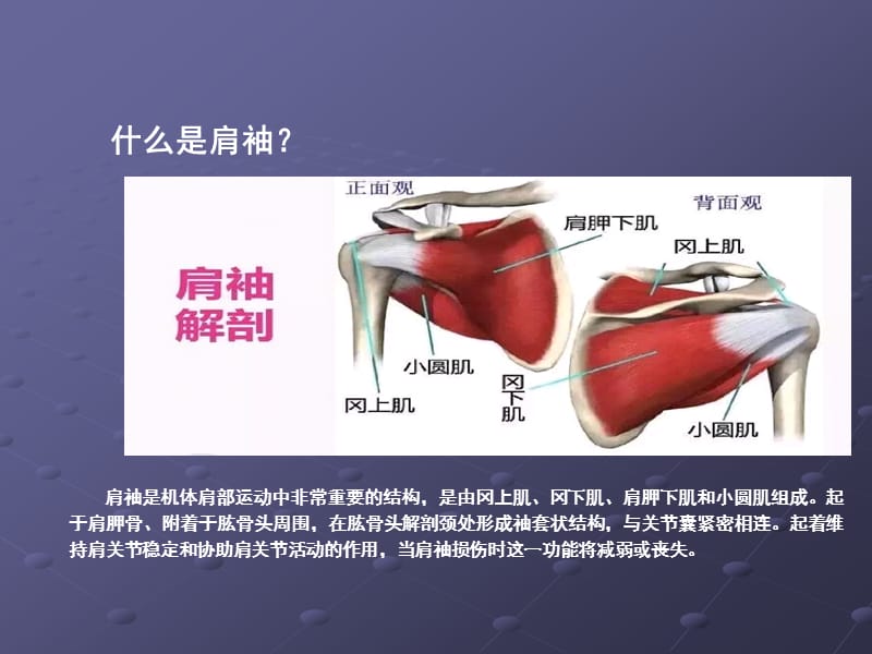 肩袖损伤护理疾病查房ppt课件_第3页