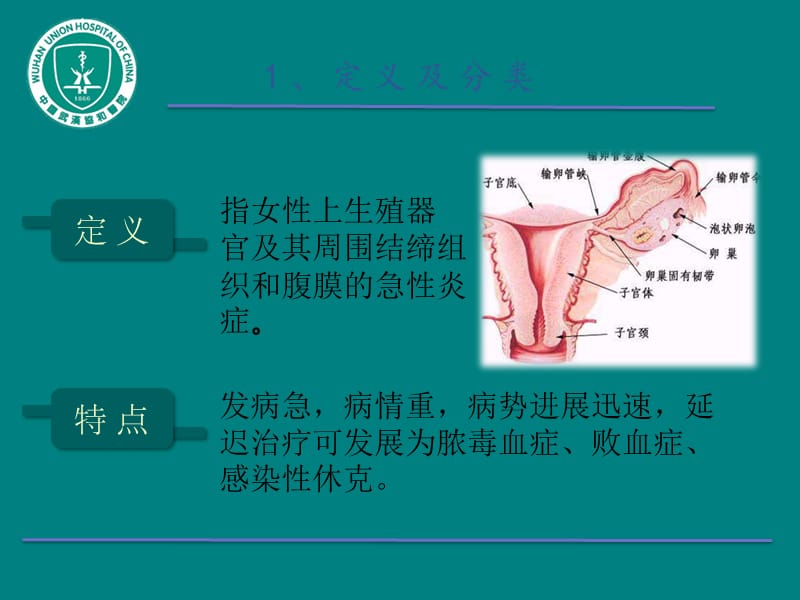 急性盆腔炎ppt课件_第3页