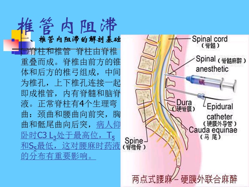 椎管内麻醉副本ppt课件_第2页