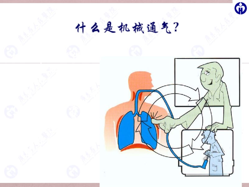 使用呼吸机病人的护理ppt课件_第2页