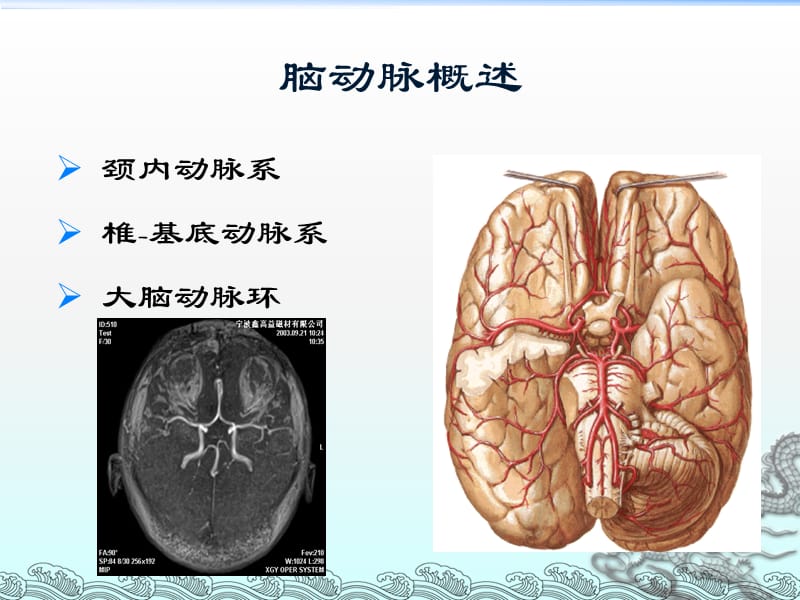 颅内和椎管内血管性疾病ppt课件_第2页