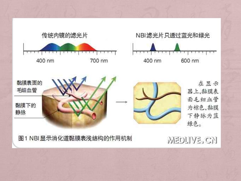 NBI内镜_第3页