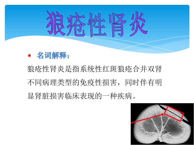 狼疮性肾炎护理ppt课件_第3页