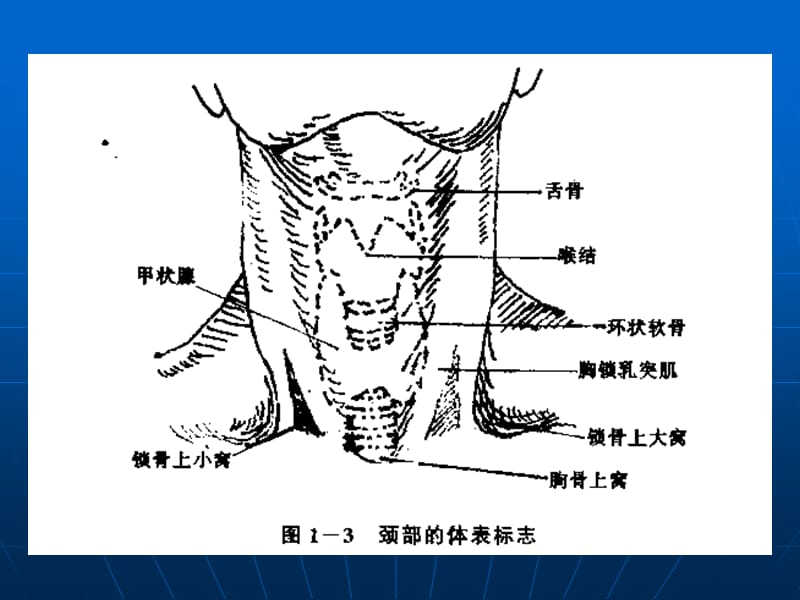 《锁骨下静脉穿刺》PPT课件.ppt_第3页