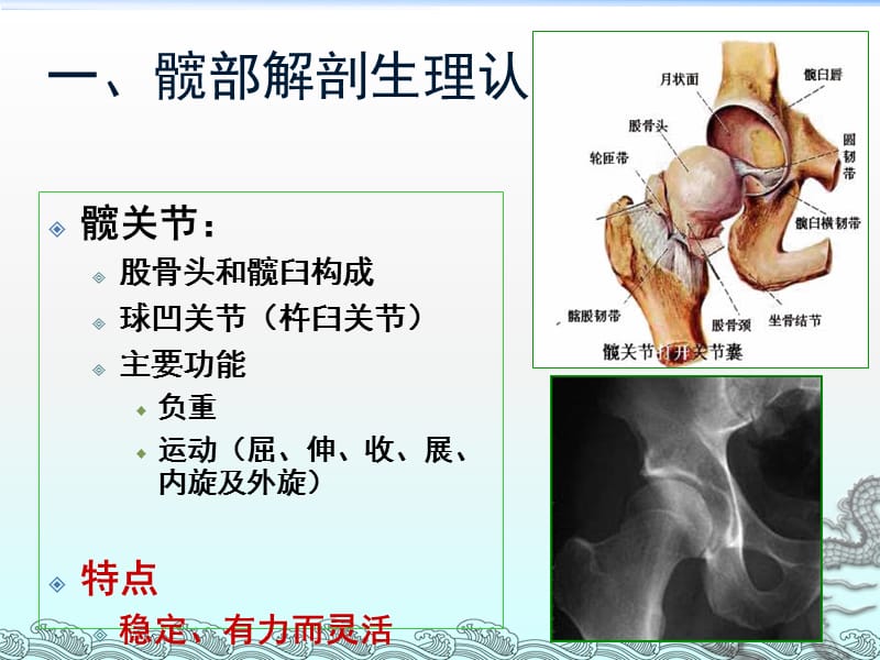 髋关节置换术后的健康宣教ppt课件_第3页