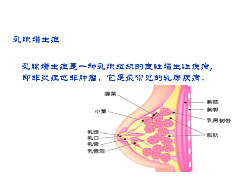 乳腺增生症ppt课件_第2页