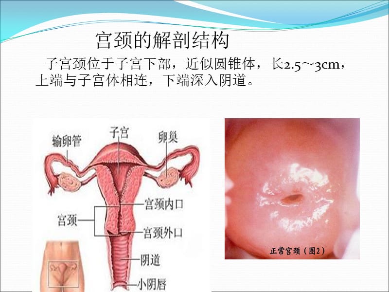 宫颈炎相关知识及其护理_第2页