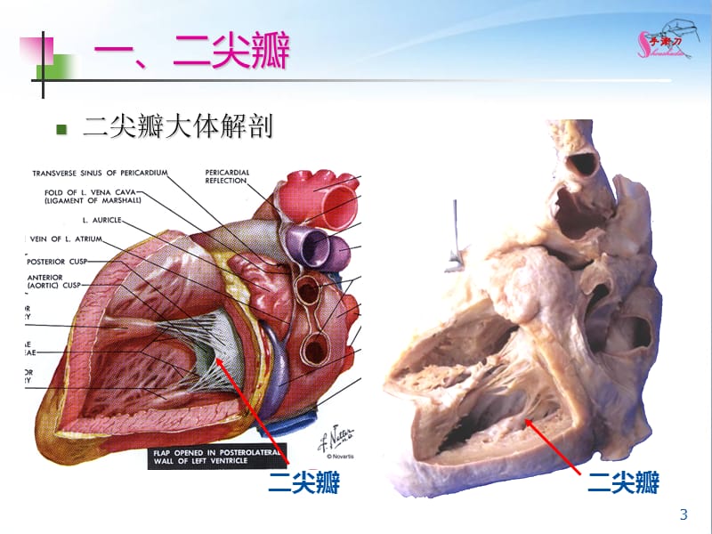 图解超声心动图评估瓣膜反流程度.ppt_第3页