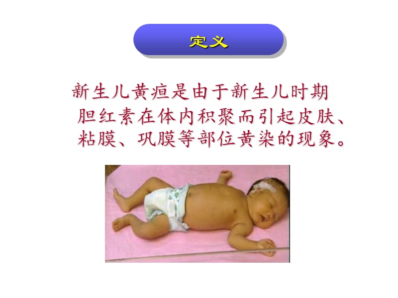 《新生儿黄疸护理》PPT课件.ppt_第3页