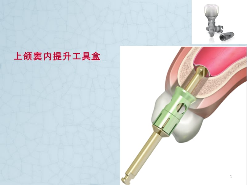 上颌窦内提升工具盒ppt课件_第1页