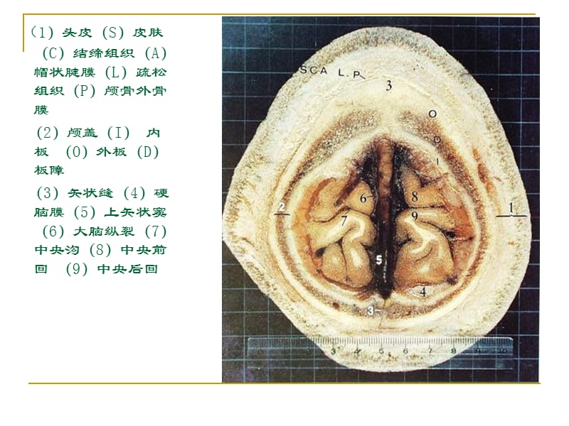 人体断层解剖图谱(大脑).ppt_第3页