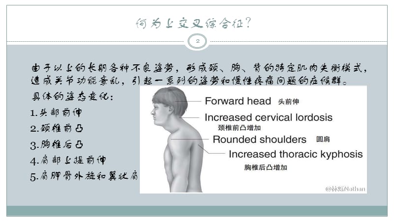 上交叉综合征的肌肉失衡及处理ppt课件_第2页