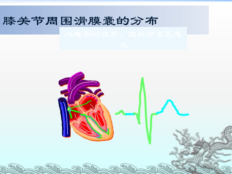 常见心电图鉴别和诊断_第2页