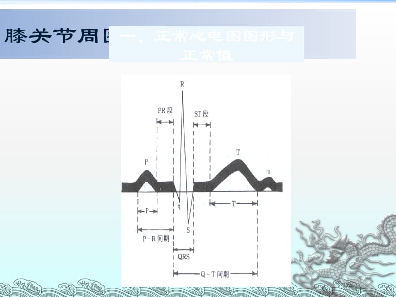 常见心电图鉴别和诊断_第3页