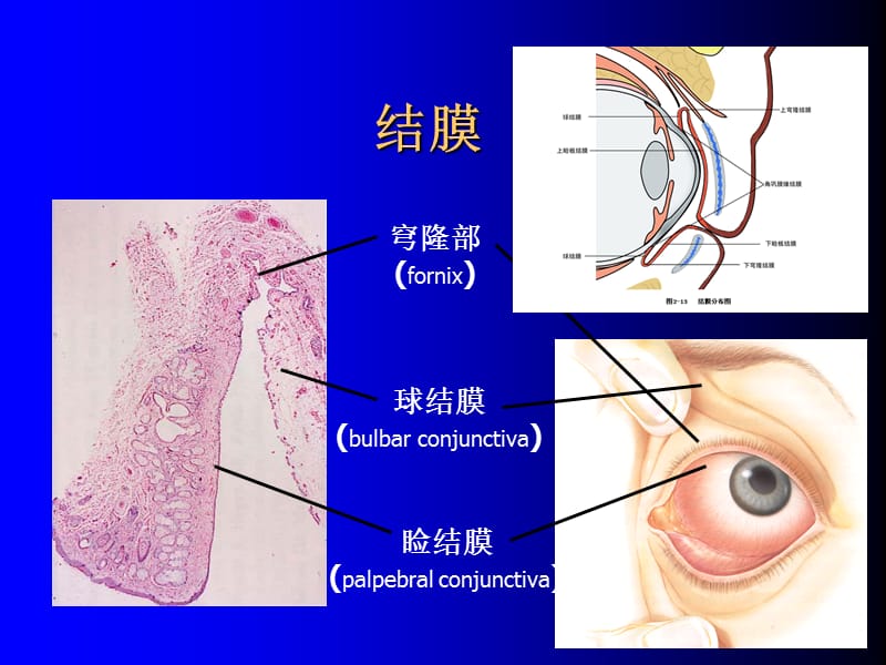 《结膜病清晰》PPT课件.ppt_第2页