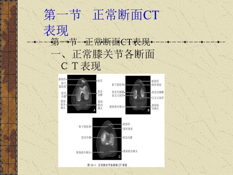 第十章 运动系统_第2页