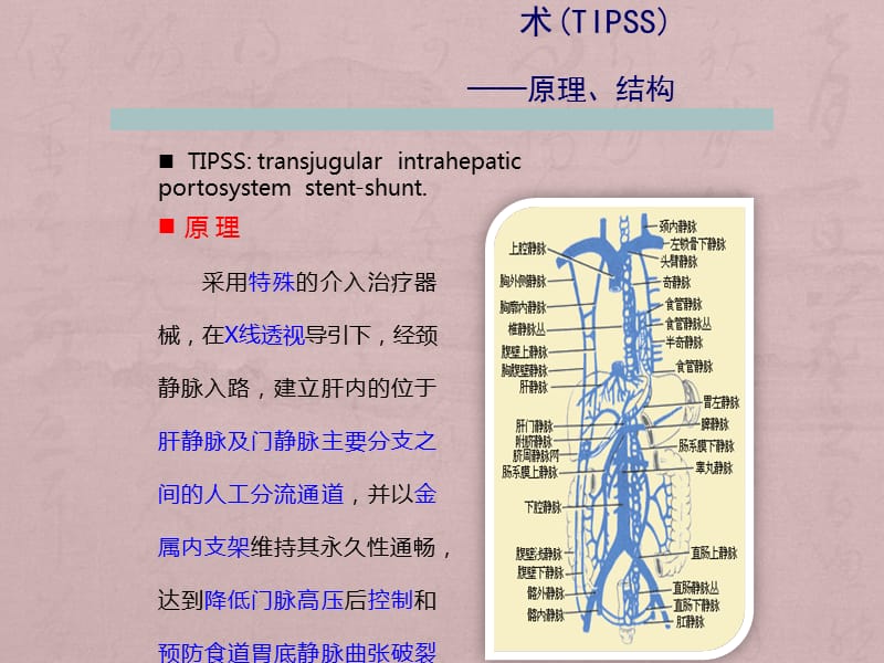 经颈静脉肝内门体分流术(TIPS)_第3页