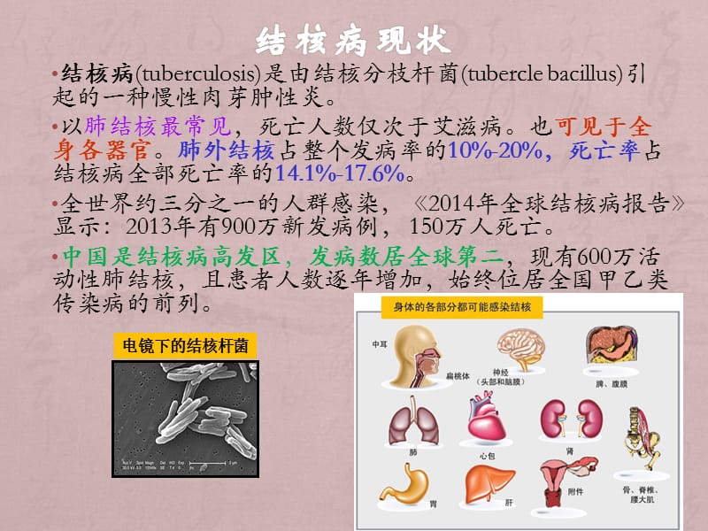 结核感染T细胞(TB-IGRA)检测及意义_第3页