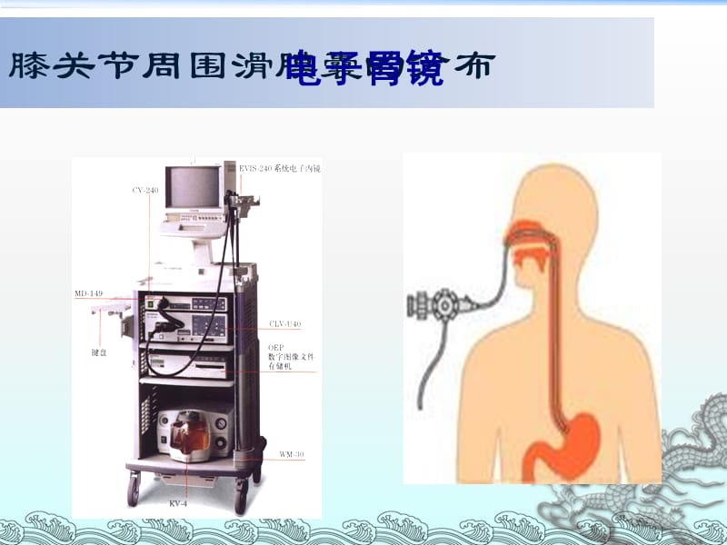 常见消化内镜的诊治_第3页