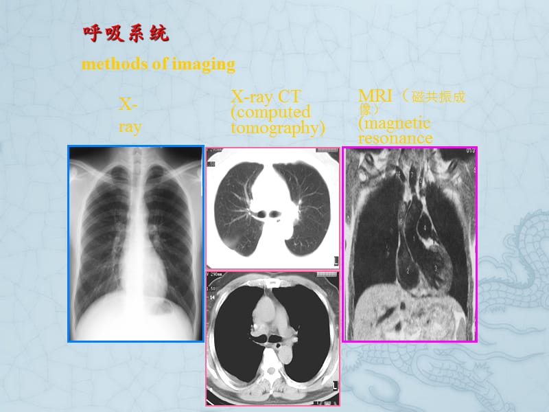 结构的正常胸部X线识别_第2页