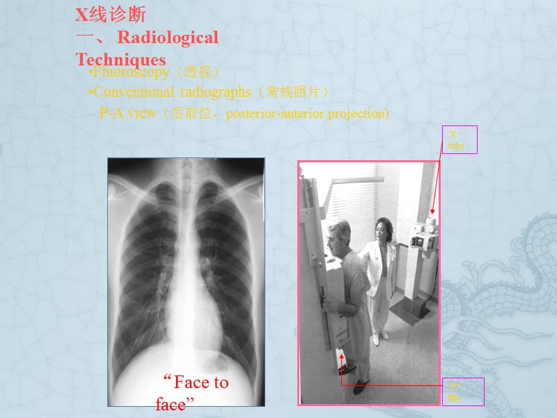 结构的正常胸部X线识别_第3页