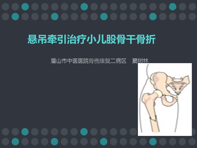 悬吊牵引治疗小儿股骨干骨折.ppt_第1页