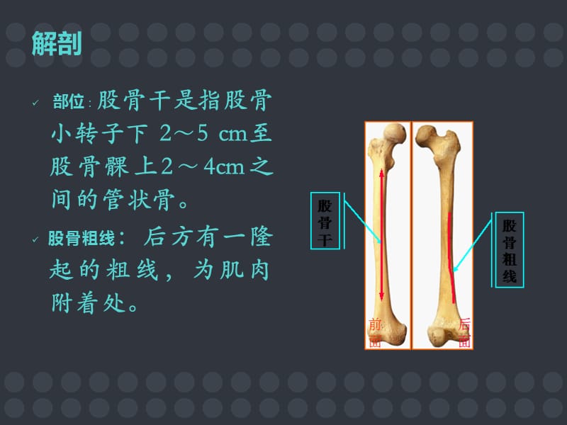 悬吊牵引治疗小儿股骨干骨折.ppt_第3页