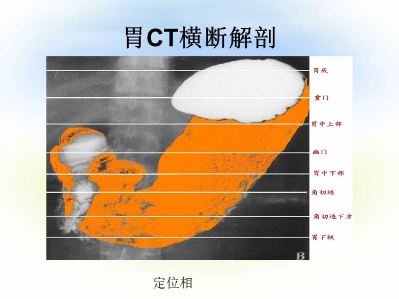 《正常腹部CT解剖》PPT课件.ppt_第3页