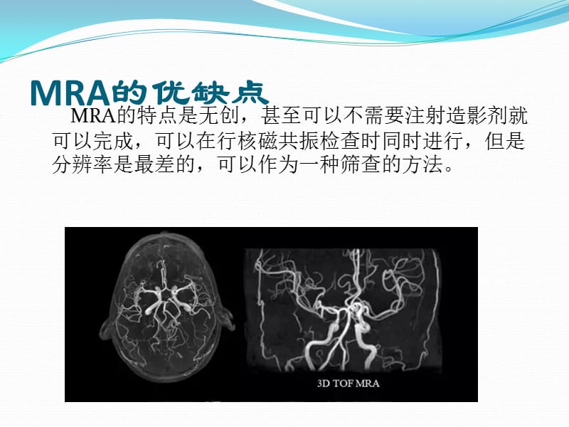 颅脑CTA和DSA对脑血管病变的诊断_第3页