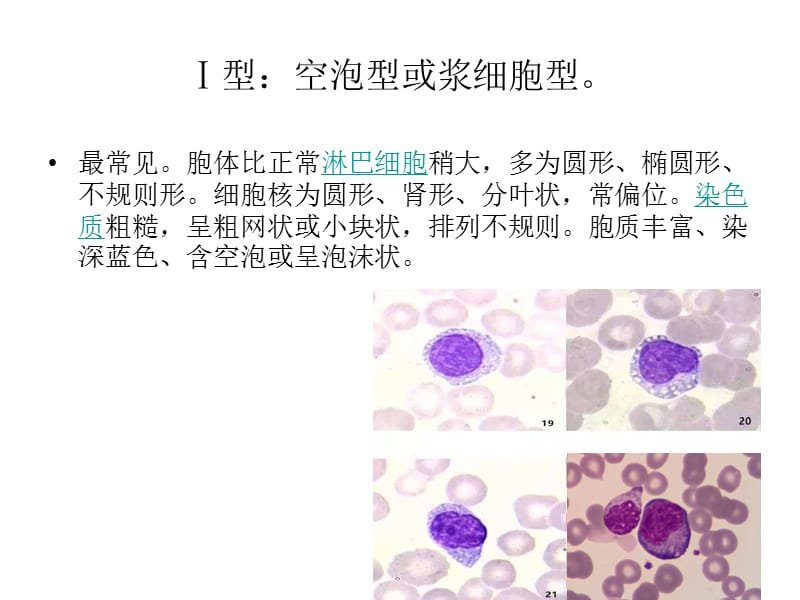 异常淋巴细胞形态.ppt_第3页