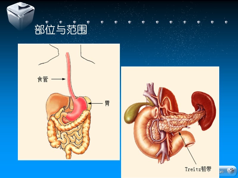 上消化道出血 新_第3页